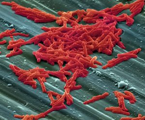 普维动物保健品有限公司, 动物饲料添加剂, 植物提取物, 植物生物素, 精油, PFA, 植物性饲料添加剂, 植物学, 植物性饲料添加剂, 新型促生长剂, 植物素, 替代抗生素促生长剂, 天然产品, 肠道健康, PlusVet Animal Health，养鸡，普维生，普乐壮，饲料添加剂，无抗养殖，植物提取物替代抗生素，